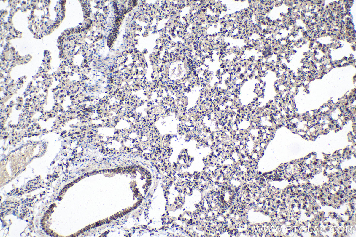 Immunohistochemical analysis of paraffin-embedded mouse lung tissue slide using KHC1616 (CDK7 IHC Kit).