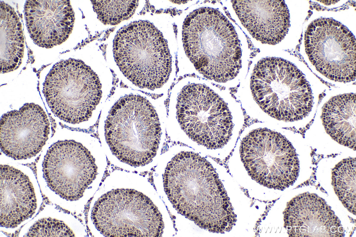 Immunohistochemical analysis of paraffin-embedded rat testis tissue slide using KHC1616 (CDK7 IHC Kit).