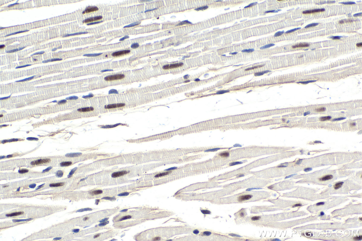 Immunohistochemical analysis of paraffin-embedded rat heart tissue slide using KHC1617 (CDK9 IHC Kit).