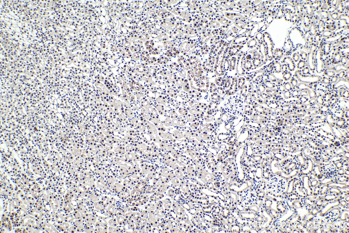 Immunohistochemical analysis of paraffin-embedded mouse kidney tissue slide using KHC1617 (CDK9 IHC Kit).