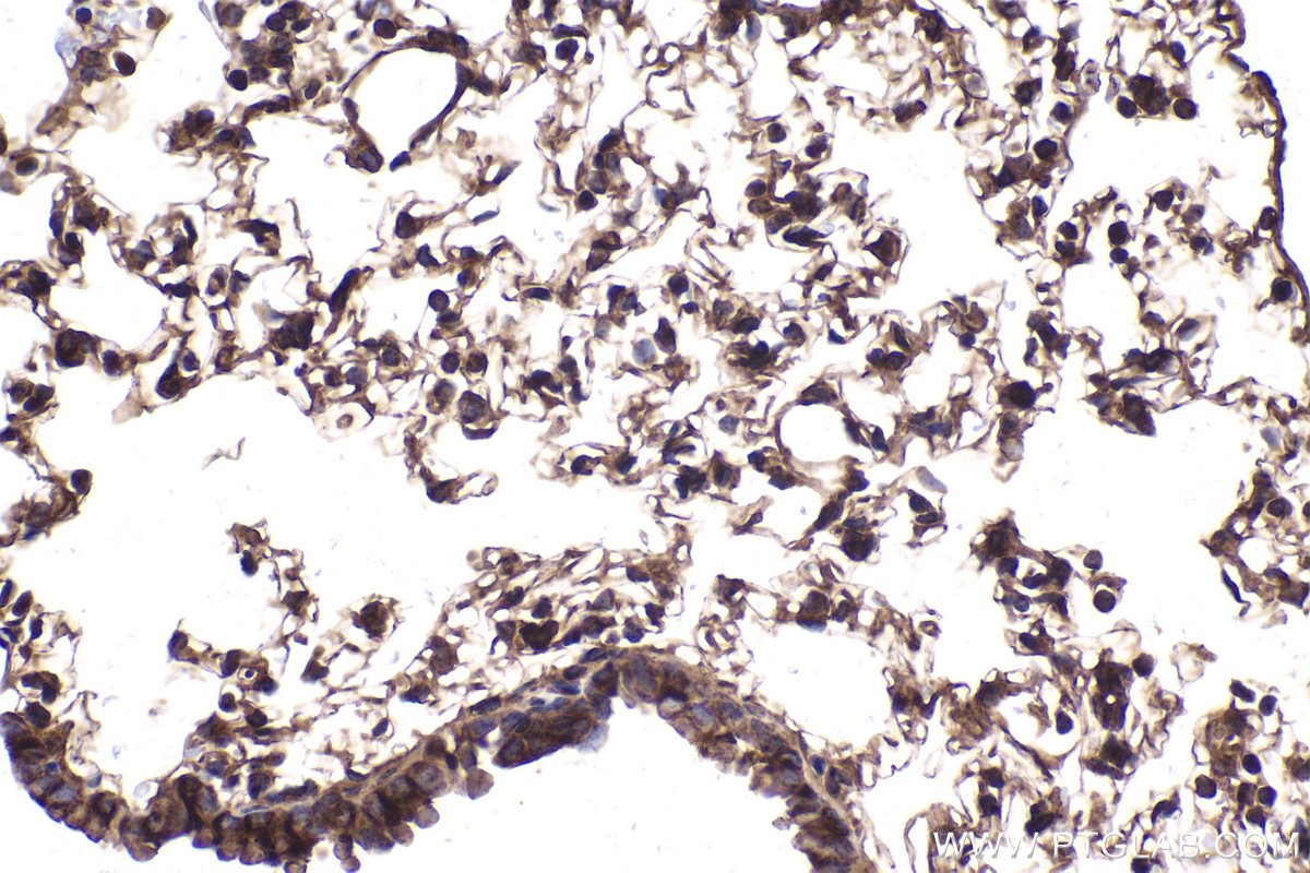Immunohistochemical analysis of paraffin-embedded mouse lung tissue slide using KHC2037 (CDR2L IHC Kit).