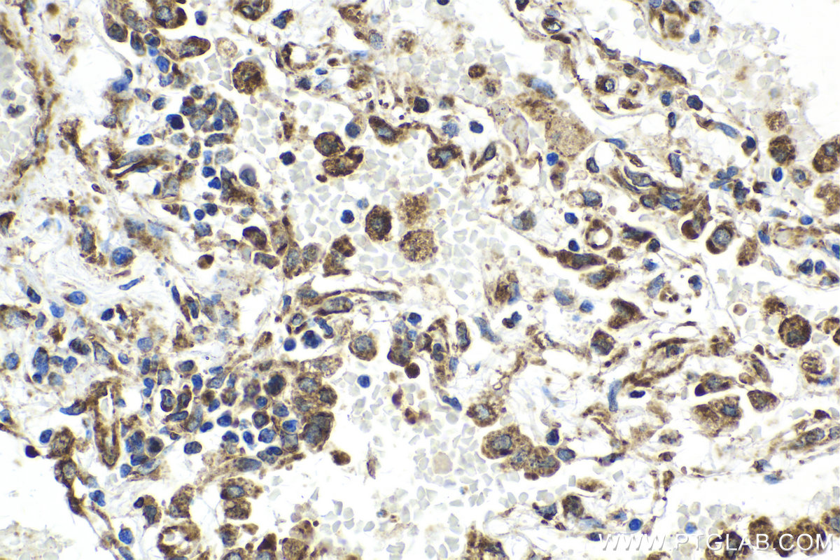 Immunohistochemical analysis of paraffin-embedded human lung tissue slide using KHC2146 (CDS2 IHC Kit).