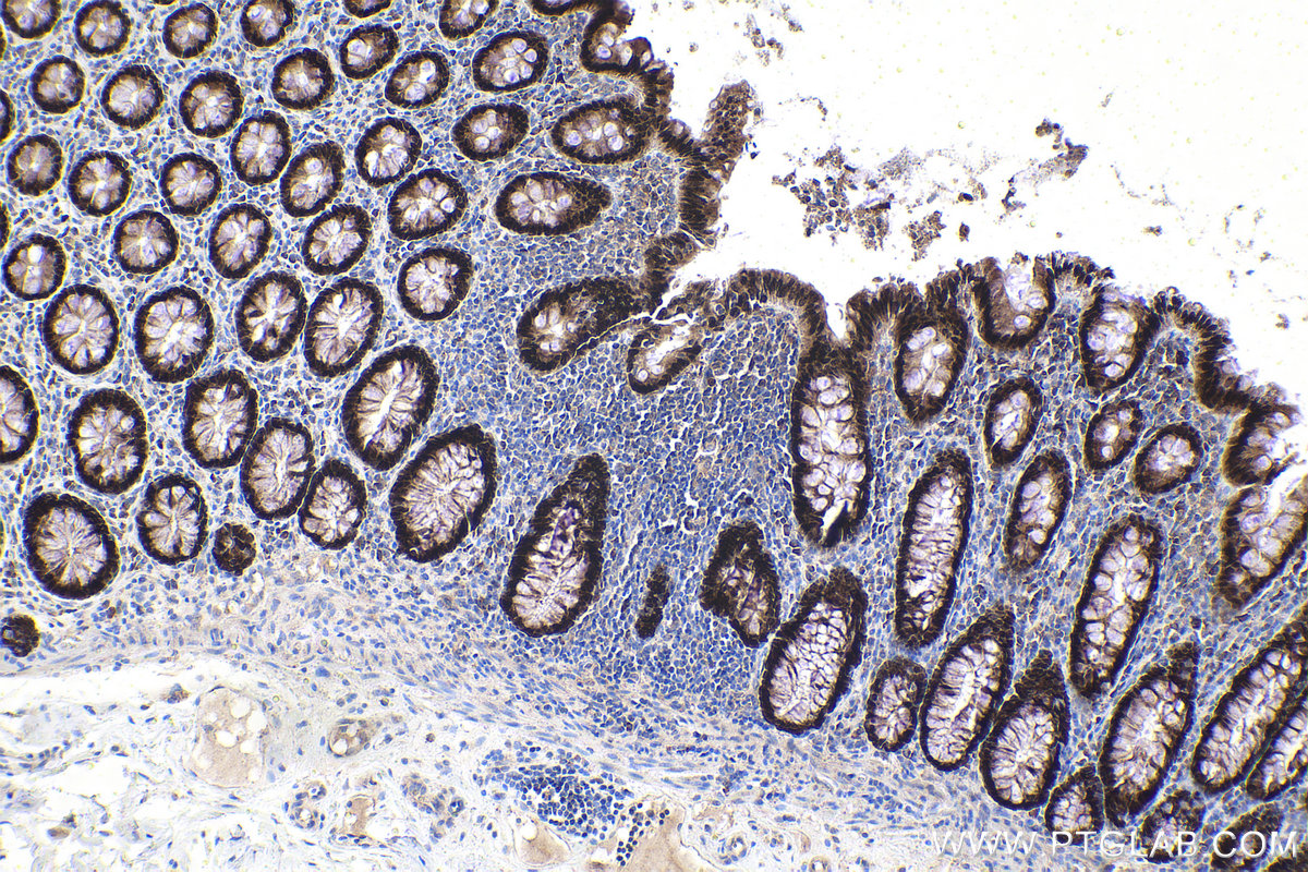 Immunohistochemical analysis of paraffin-embedded human colon tissue slide using KHC1609 (CDX1 IHC Kit).