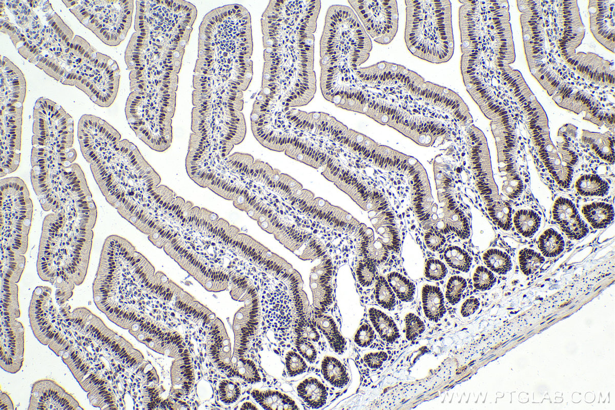 Immunohistochemical analysis of paraffin-embedded rat small intestine tissue slide using KHC1625 (CEBPG IHC Kit).