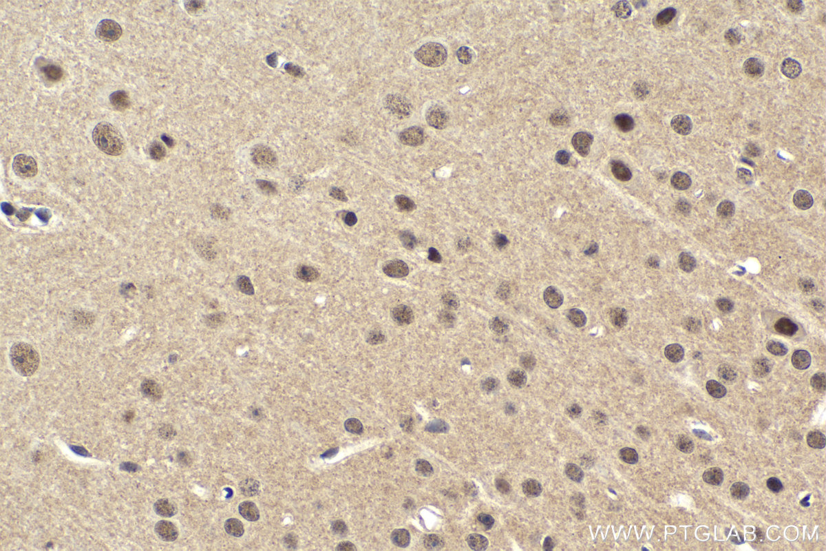 Immunohistochemical analysis of paraffin-embedded mouse brain tissue slide using KHC1625 (CEBPG IHC Kit).