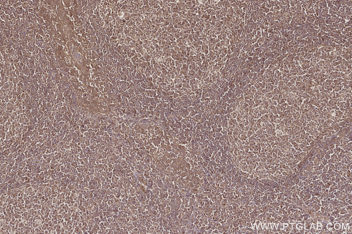 Immunohistochemical analysis of paraffin-embedded human tonsillitis tissue slide using KHC2724 (CEP192 IHC Kit).