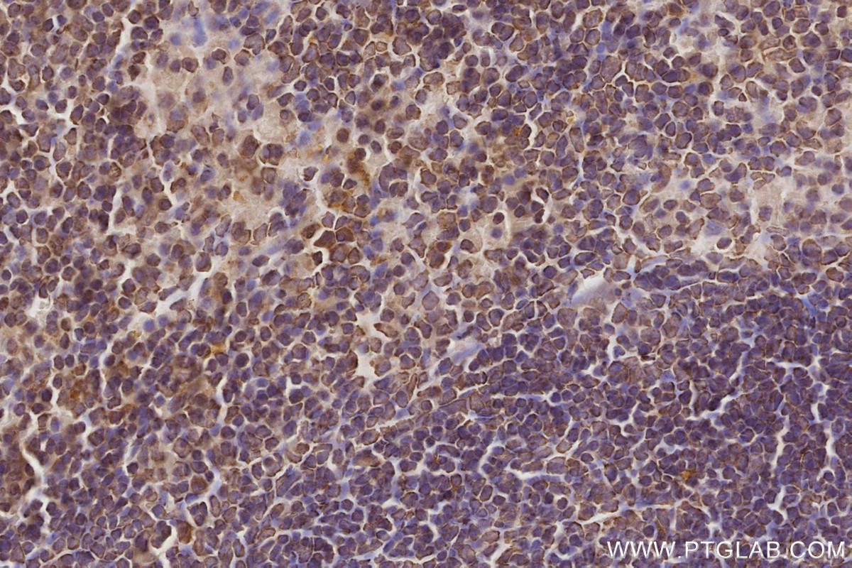 Immunohistochemical analysis of paraffin-embedded mouse spleen tissue slide using KHC2872 (CEP250/CNAP1 IHC Kit).