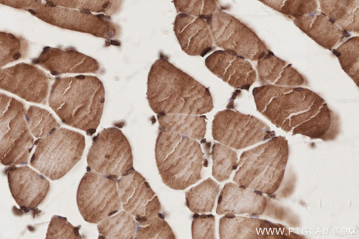 Immunohistochemical analysis of paraffin-embedded mouse skeletal muscle tissue slide using KHC2872 (CEP250/CNAP1 IHC Kit).