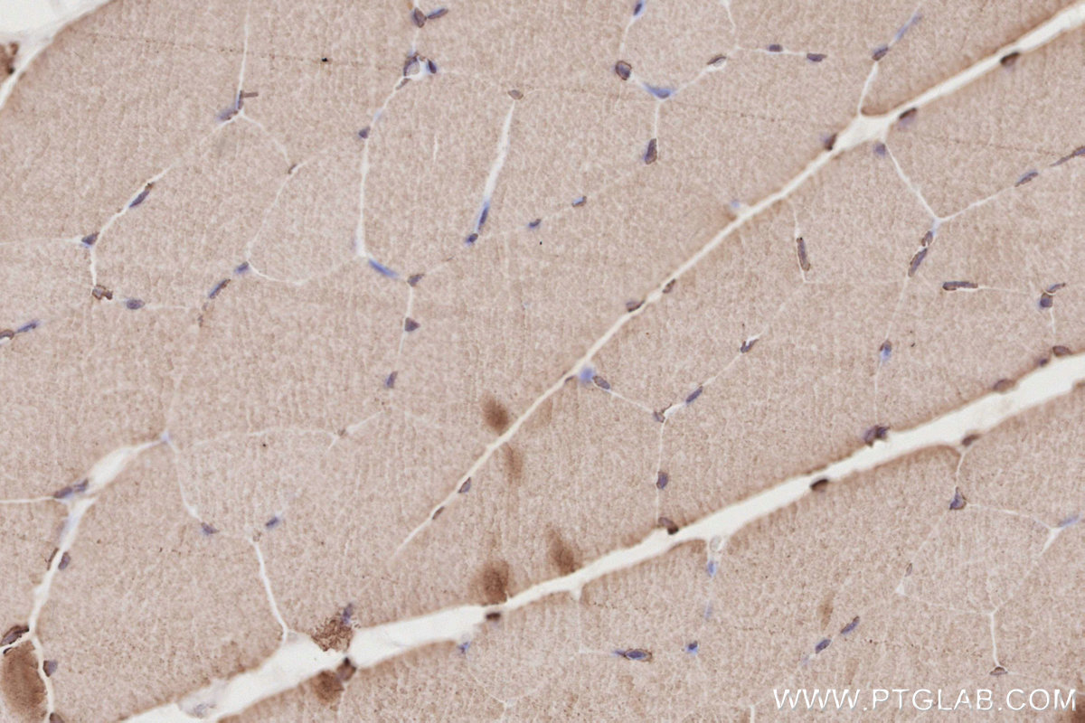 Immunohistochemical analysis of paraffin-embedded rat skeletal muscle tissue slide using KHC2872 (CEP250/CNAP1 IHC Kit).