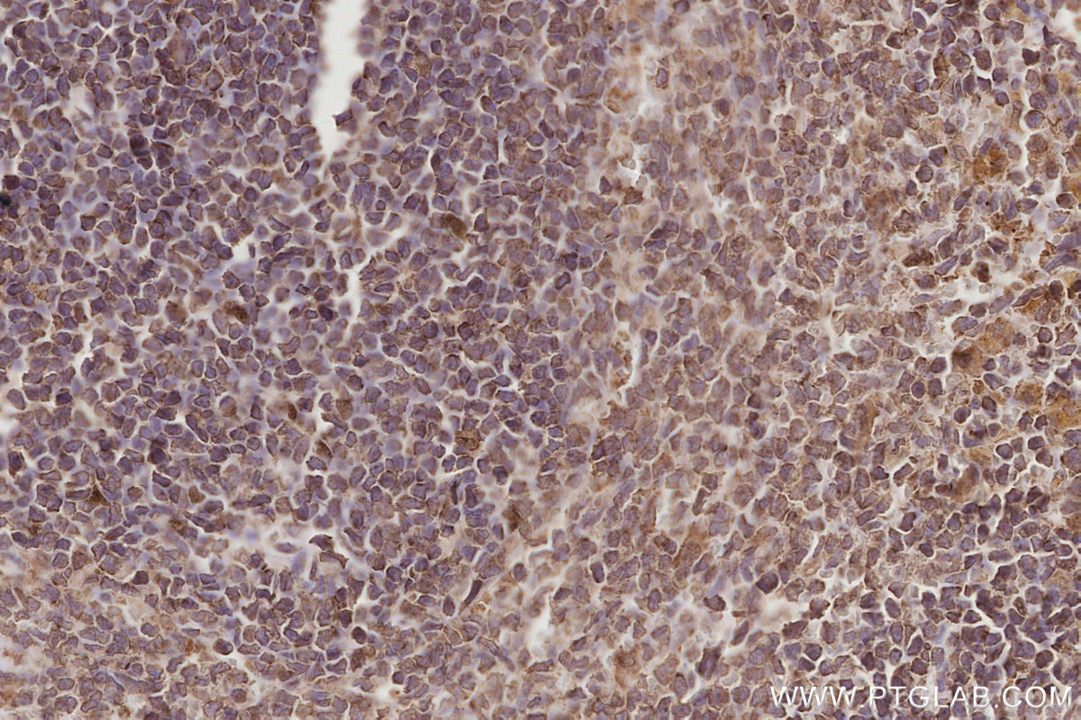 Immunohistochemical analysis of paraffin-embedded rat spleen tissue slide using KHC2872 (CEP250/CNAP1 IHC Kit).