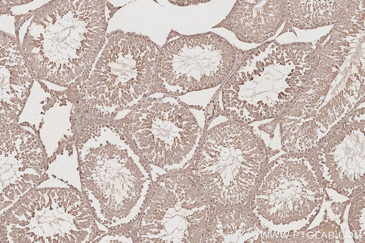 Immunohistochemical analysis of paraffin-embedded rat testis tissue slide using KHC2872 (CEP250/CNAP1 IHC Kit).