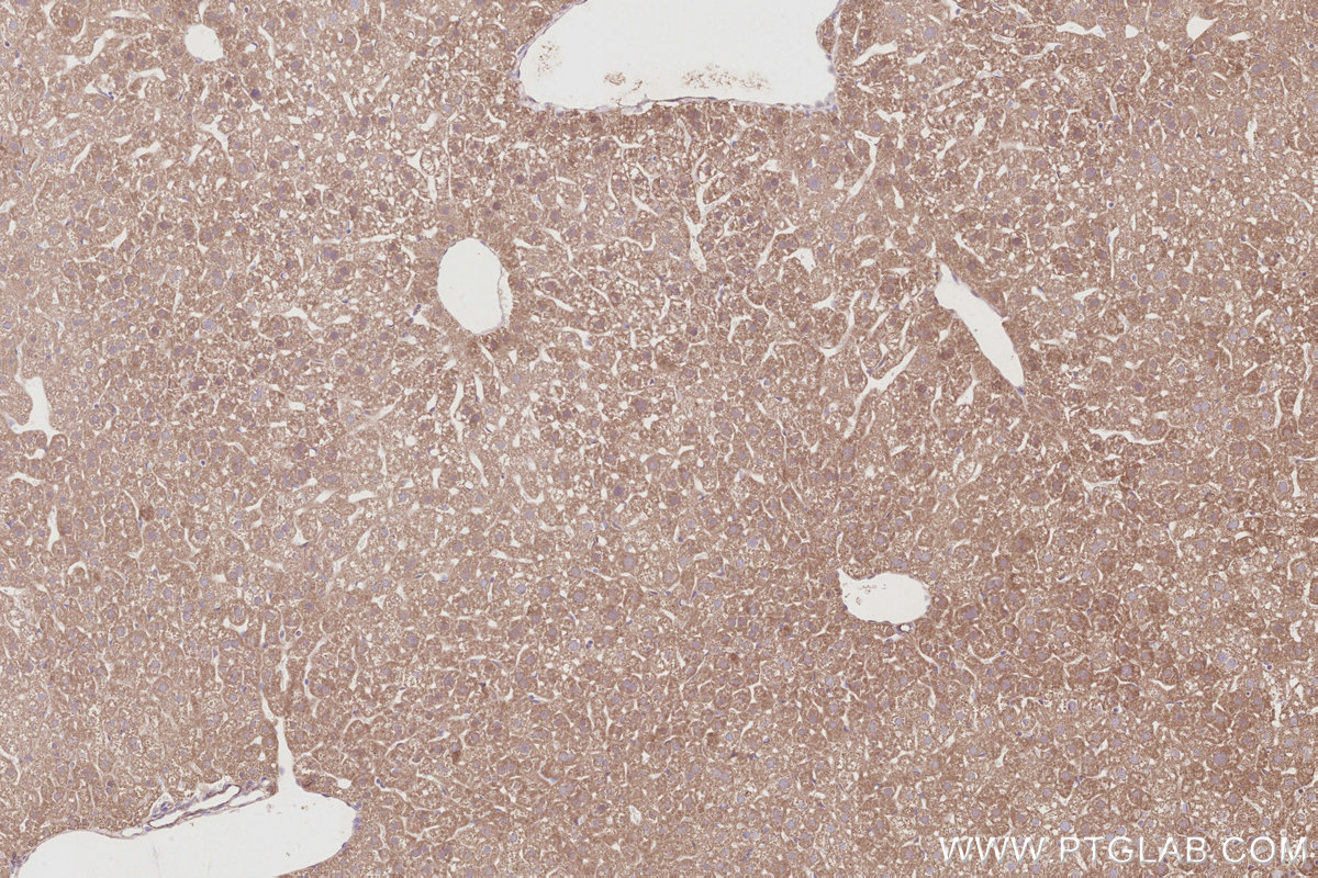 Immunohistochemical analysis of paraffin-embedded mouse liver tissue slide using KHC2892 (CEP295 IHC Kit). Immunohistochemical analysis of paraffin-embedded mouse liver tissue slide using KHC2892 (CEP295 IHC Kit).