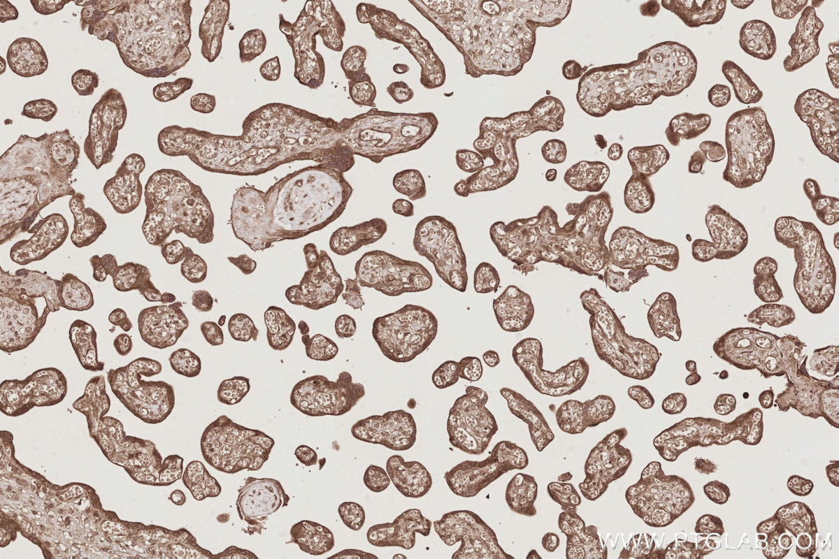Immunohistochemical analysis of paraffin-embedded human placenta tissue slide using KHC2894 (CEP44 IHC Kit).