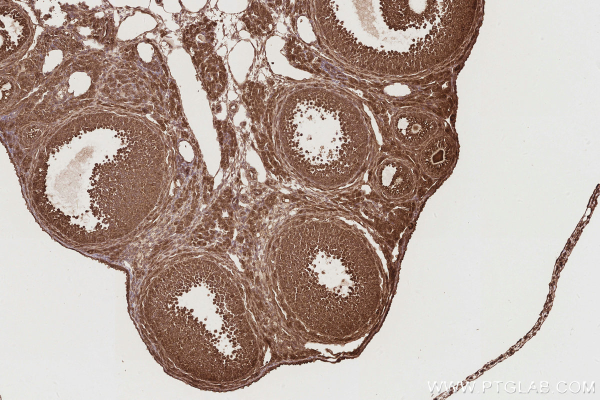 Immunohistochemical analysis of paraffin-embedded mouse ovary tissue slide using KHC2894 (CEP44 IHC Kit).