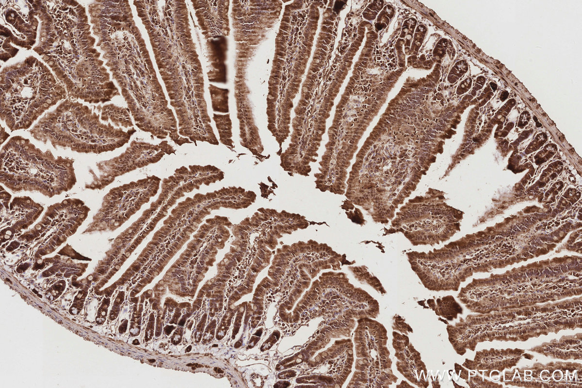 Immunohistochemical analysis of paraffin-embedded mouse small intestine tissue slide using KHC2894 (CEP44 IHC Kit).