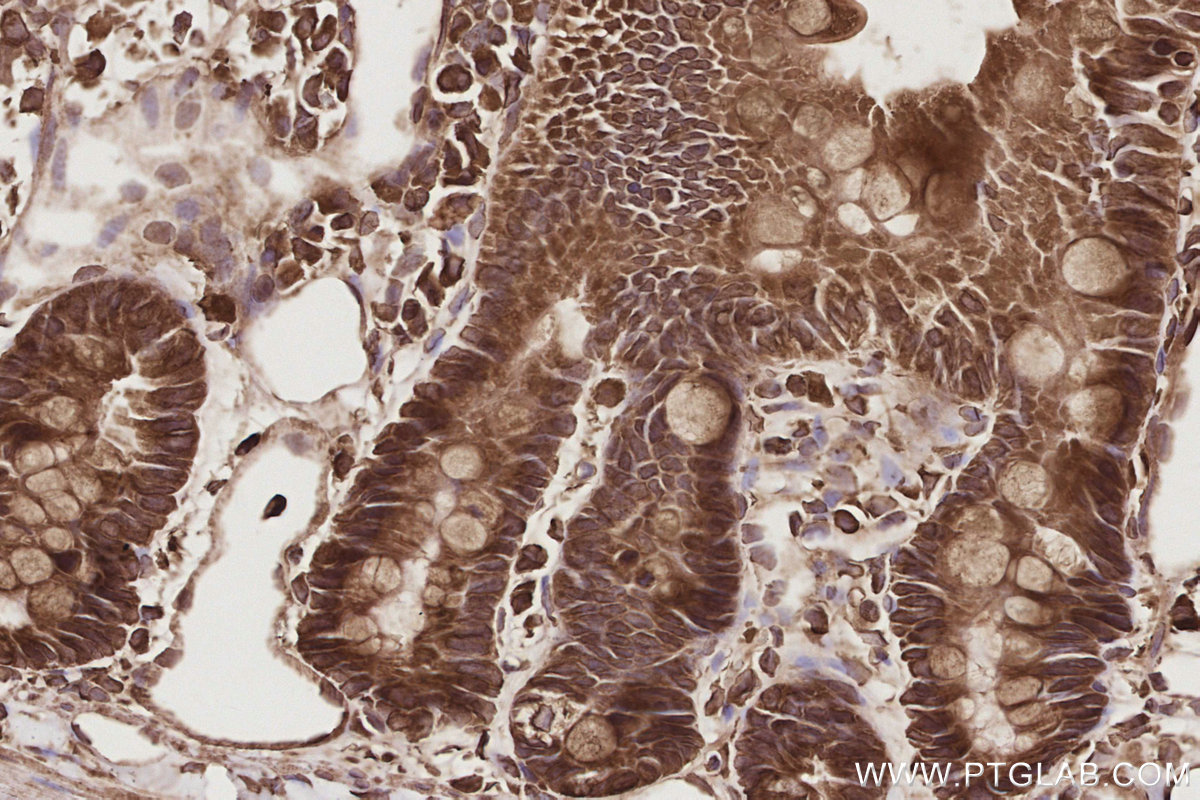 Immunohistochemical analysis of paraffin-embedded rat small intestine tissue slide using KHC2894 (CEP44 IHC Kit).