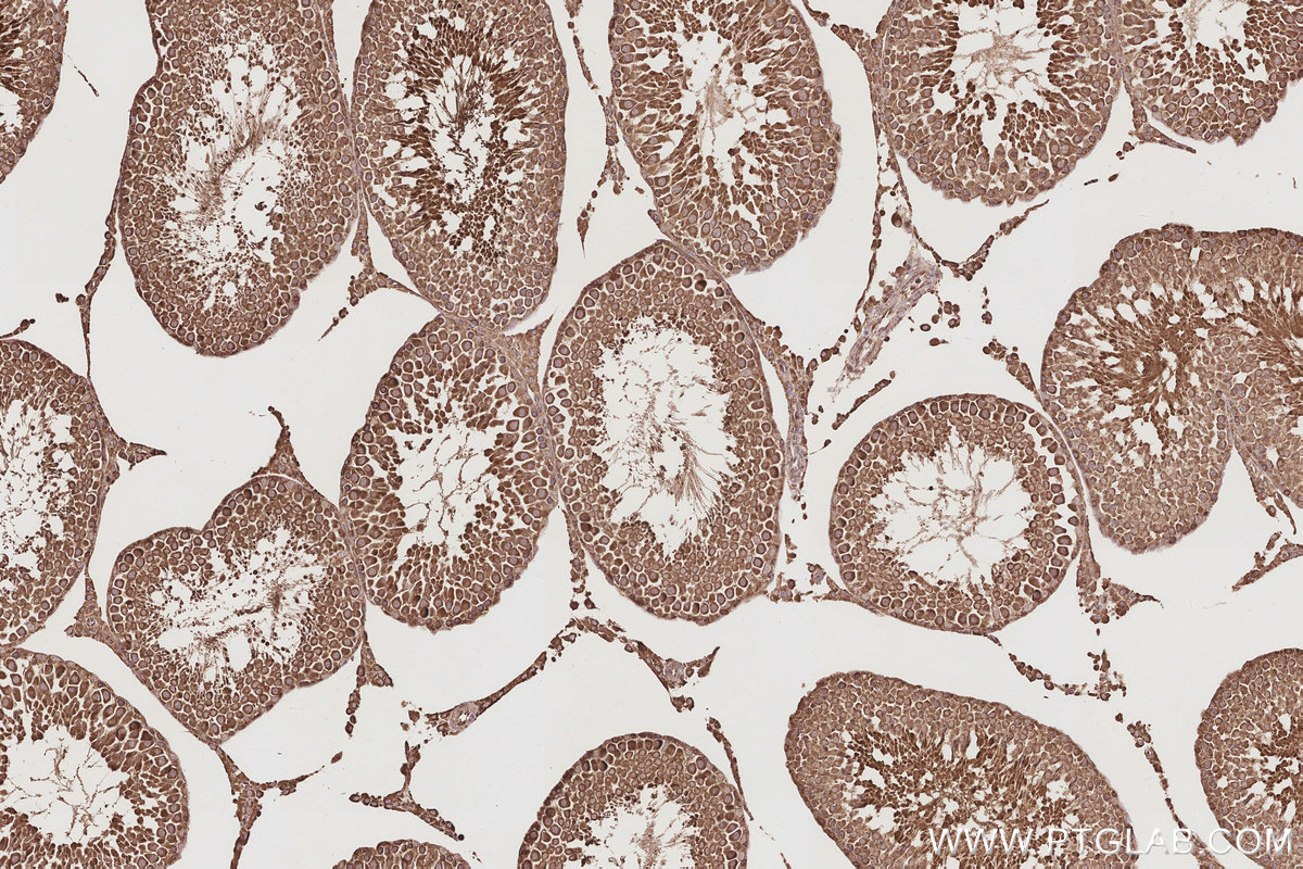 Immunohistochemical analysis of paraffin-embedded rat testis tissue slide using KHC2894 (CEP44 IHC Kit).