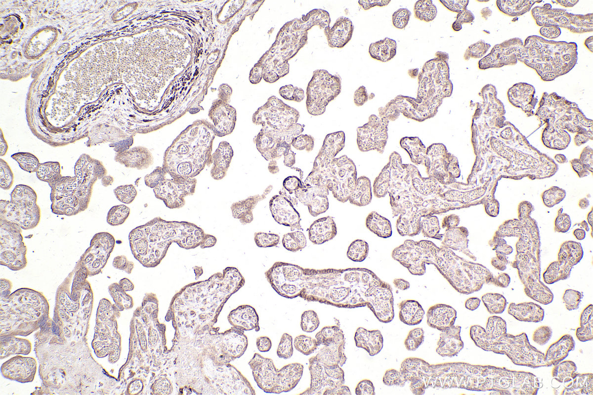 Immunohistochemical analysis of paraffin-embedded human placenta tissue slide using KHC2533 (CEP55 IHC Kit).