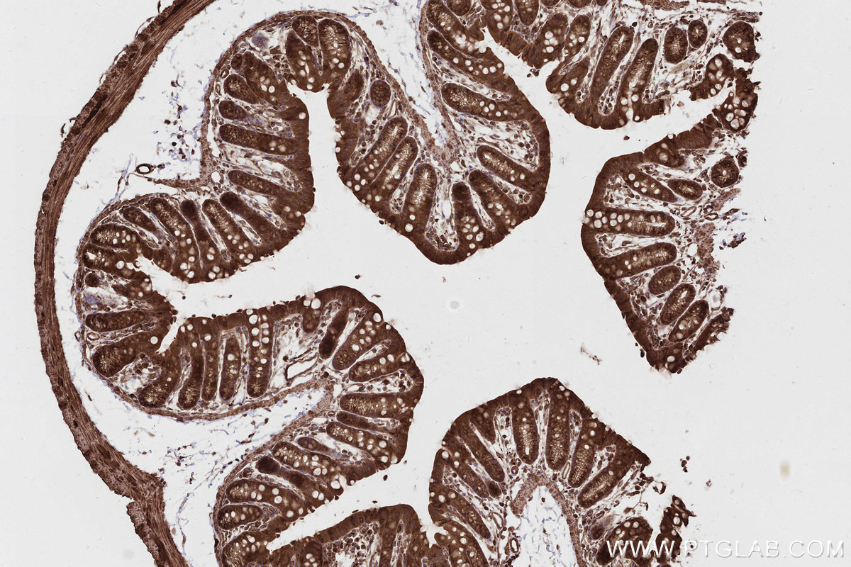 Immunohistochemical analysis of paraffin-embedded mouse colon tissue slide using KHC2807 (CEP63 IHC Kit).