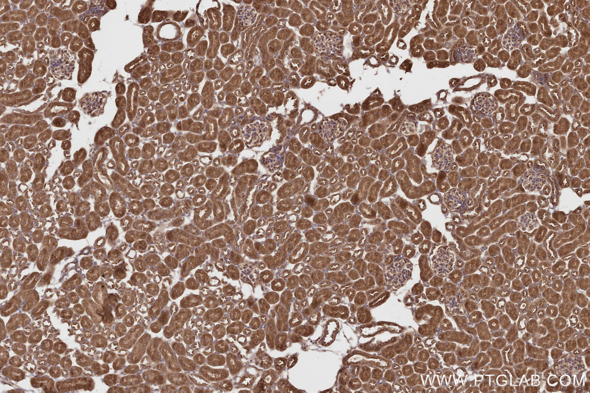 Immunohistochemical analysis of paraffin-embedded mouse kidney tissue slide using KHC2807 (CEP63 IHC Kit).