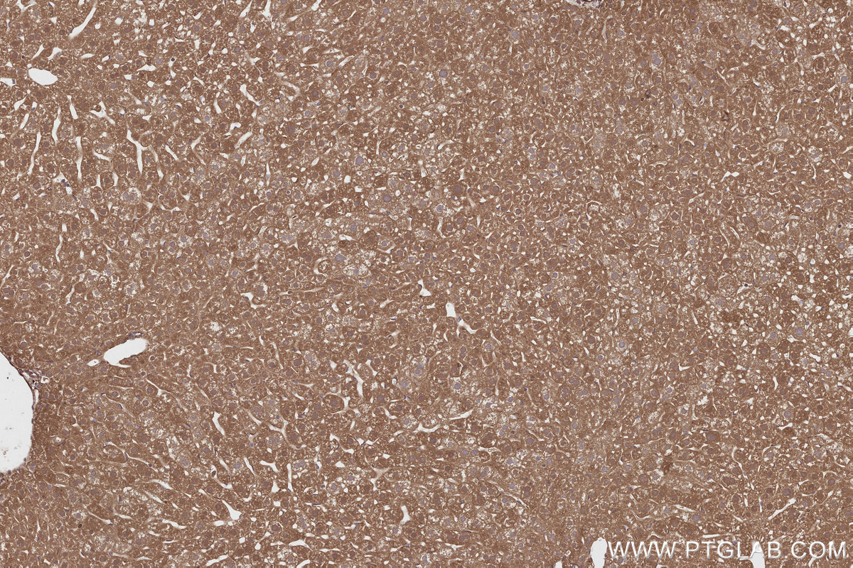 Immunohistochemical analysis of paraffin-embedded mouse liver tissue slide using KHC2807 (CEP63 IHC Kit).