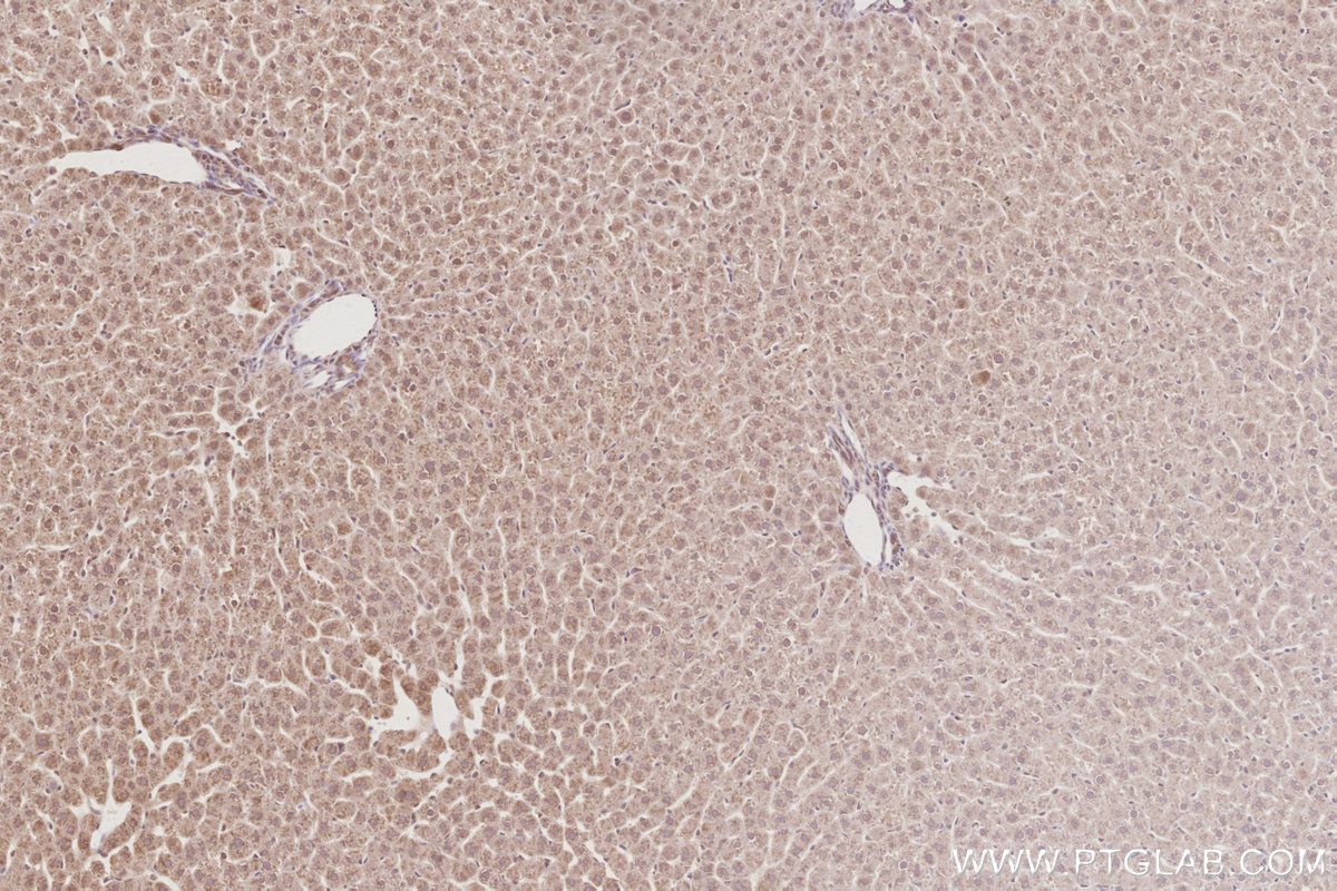 Immunohistochemical analysis of paraffin-embedded rat liver tissue slide using KHC3077 (CEP83 IHC Kit). Immunohistochemical analysis of paraffin-embedded rat liver tissue slide using KHC3077 (CEP83 IHC Kit).