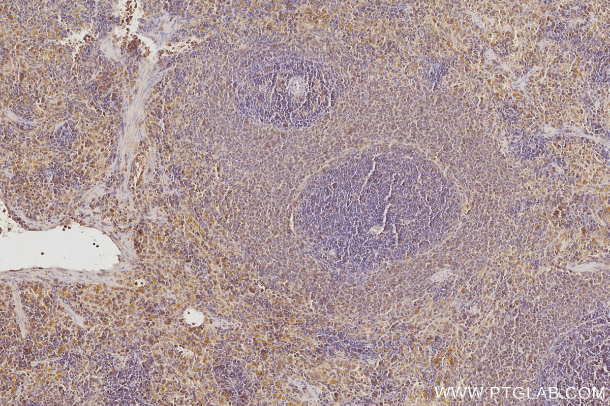 Immunohistochemical analysis of paraffin-embedded rat spleen tissue slide using KHC3093 (CEPT1 IHC Kit).