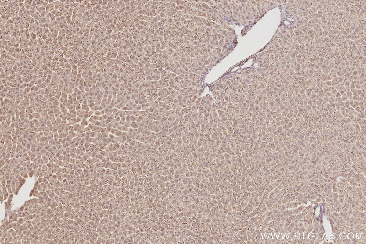 Immunohistochemical analysis of paraffin-embedded rat liver tissue slide using KHC3093 (CEPT1 IHC Kit).