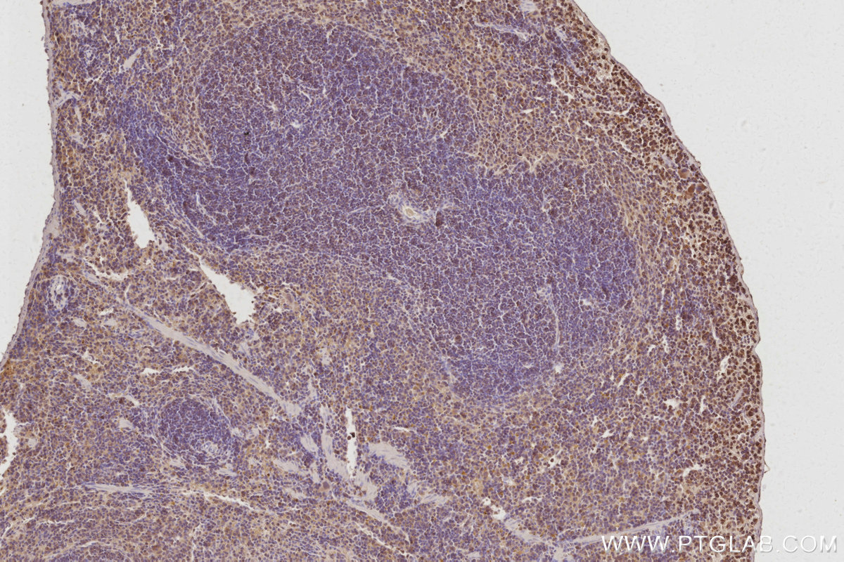 Immunohistochemical analysis of paraffin-embedded mouse spleen tissue slide using KHC3093 (CEPT1 IHC Kit).