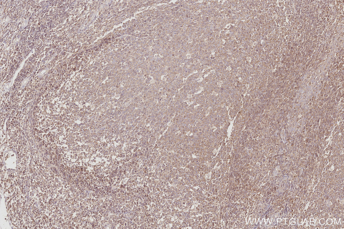 Immunohistochemical analysis of paraffin-embedded human tonsillitis tissue slide using KHC3093 (CEPT1 IHC Kit).