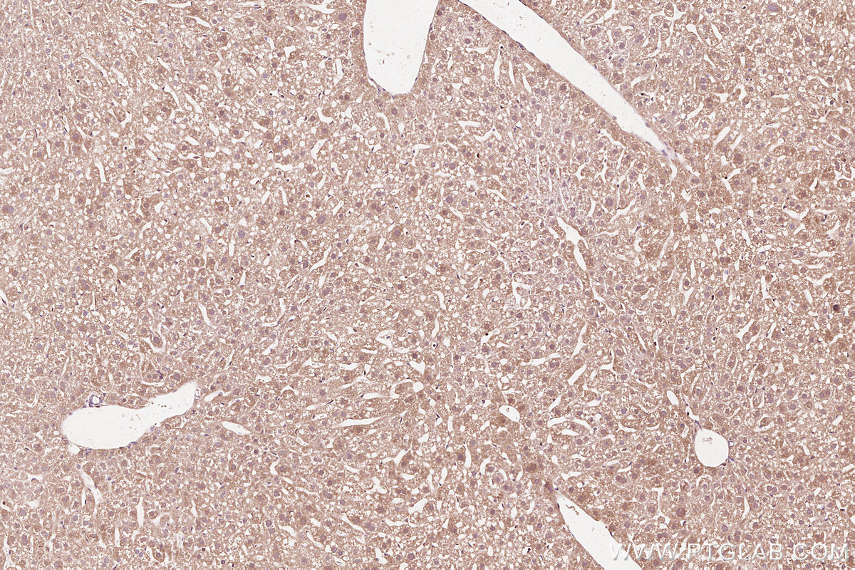 Immunohistochemical analysis of paraffin-embedded mouse liver tissue slide using KHC3093 (CEPT1 IHC Kit).