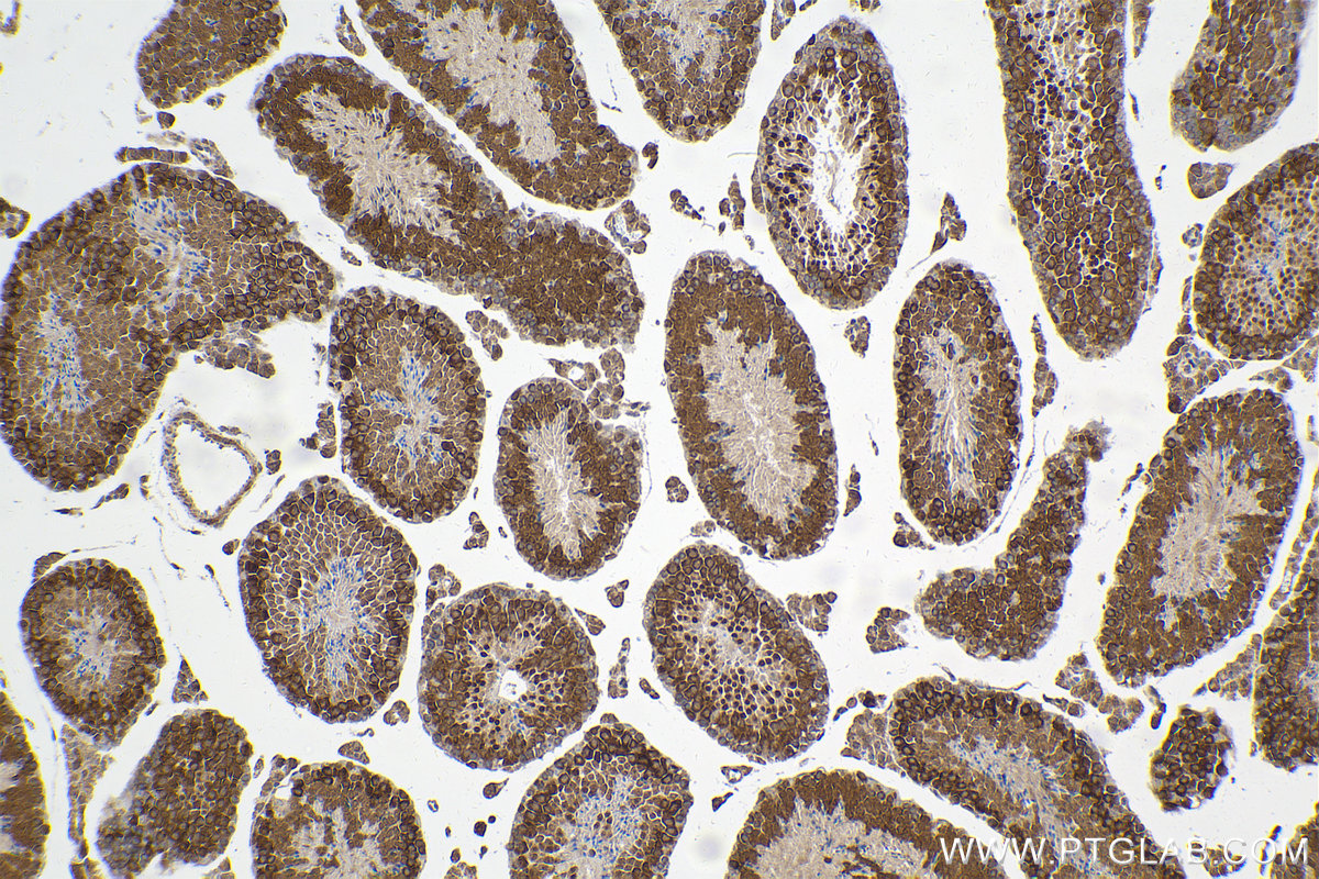 Immunohistochemical analysis of paraffin-embedded mouse testis tissue slide using KHC2068 (CETN3 IHC Kit).