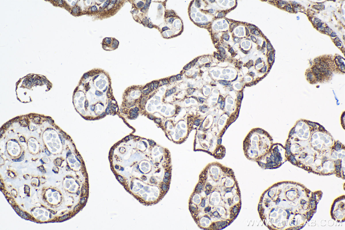 Immunohistochemical analysis of paraffin-embedded human placenta tissue slide using KHC2068 (CETN3 IHC Kit).