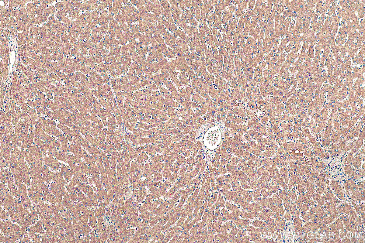 Immunohistochemical analysis of paraffin-embedded human liver tissue slide using KHC0409 (CFH IHC Kit).