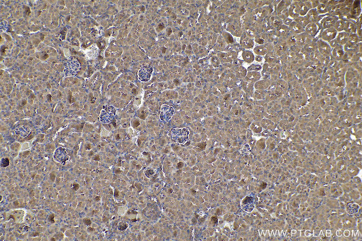 Immunohistochemical analysis of paraffin-embedded mouse kidney tissue slide using KHC0732 (CFL2 IHC Kit).