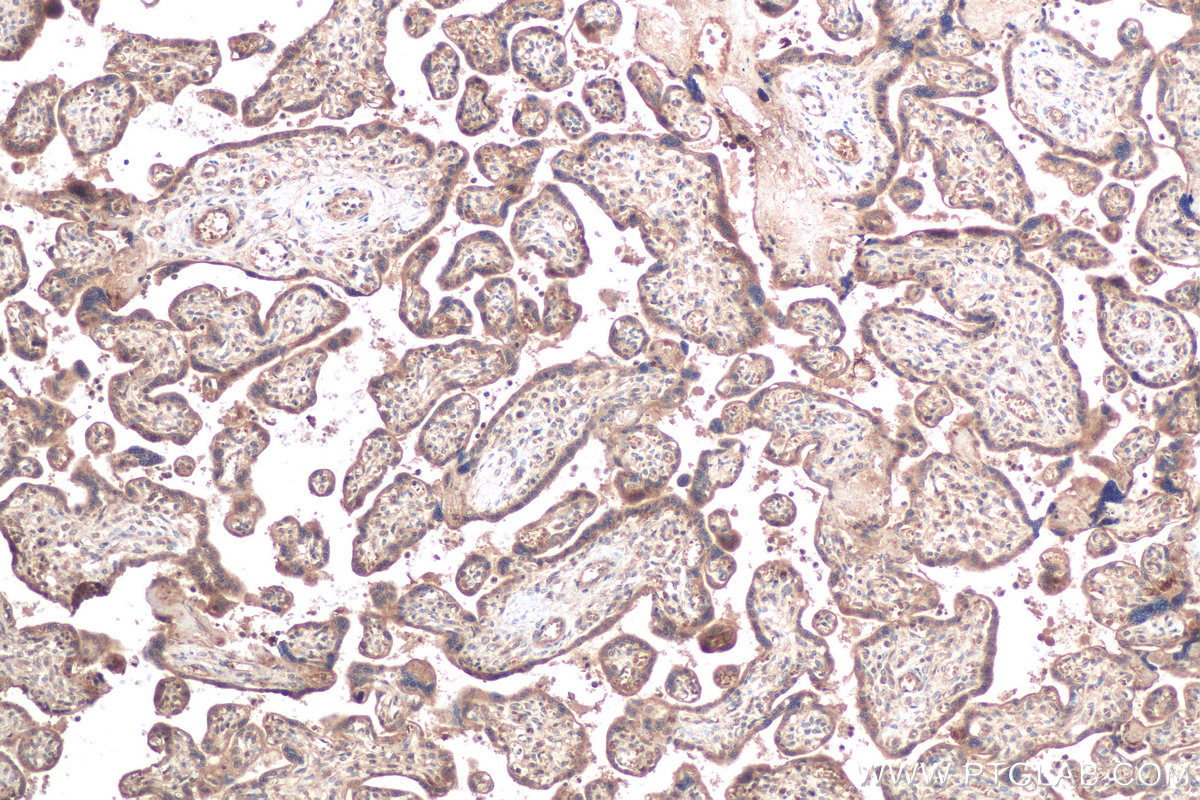 Immunohistochemical analysis of paraffin-embedded human placenta tissue slide using KHC0610 (CFLAR/FLIP IHC Kit).