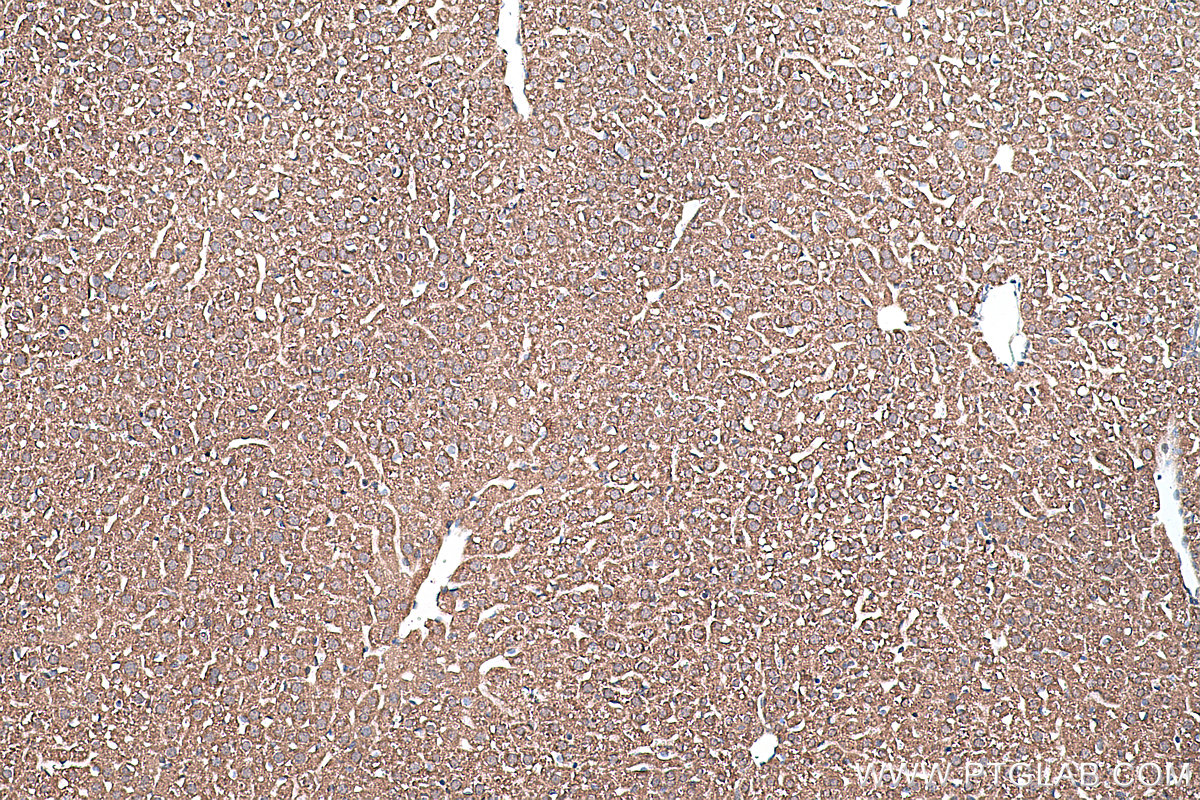 Immunohistochemical analysis of paraffin-embedded mouse liver tissue slide using KHC0410 (CHCHD2 IHC Kit).