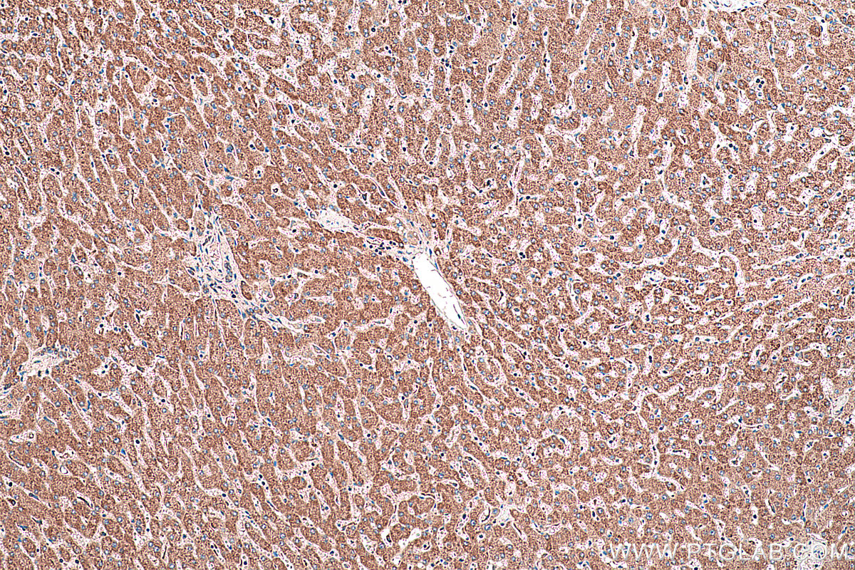 Immunohistochemical analysis of paraffin-embedded human liver tissue slide using KHC0410 (CHCHD2 IHC Kit).