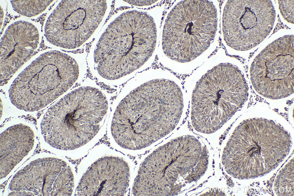 Immunohistochemical analysis of paraffin-embedded rat testis tissue slide using KHC1425 (CHD1 IHC Kit).