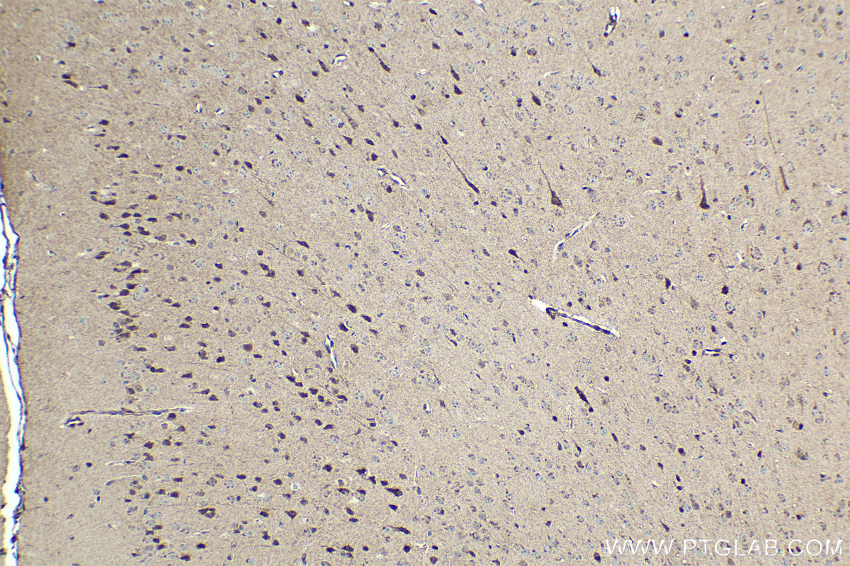 Immunohistochemical analysis of paraffin-embedded mouse brain tissue slide using KHC1425 (CHD1 IHC Kit).