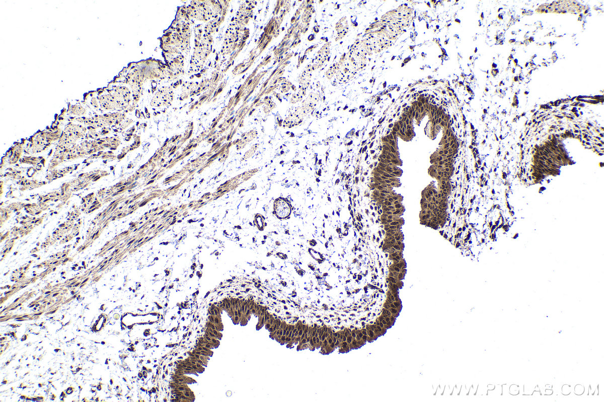 Immunohistochemical analysis of paraffin-embedded rat bladder tissue slide using KHC1694 (CHD3 IHC Kit).