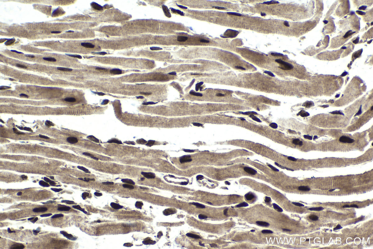 Immunohistochemical analysis of paraffin-embedded mouse heart tissue slide using KHC1737 (CHD4 IHC Kit).