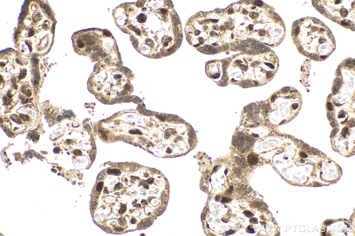 Immunohistochemical analysis of paraffin-embedded human placenta tissue slide using KHC2153 (CHEK2 IHC Kit).