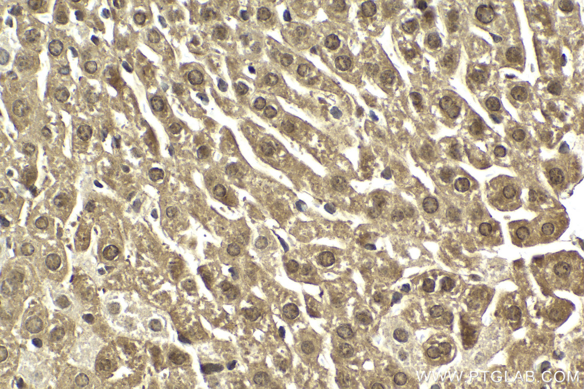 Immunohistochemical analysis of paraffin-embedded mouse liver tissue slide using KHC2153 (CHEK2 IHC Kit).