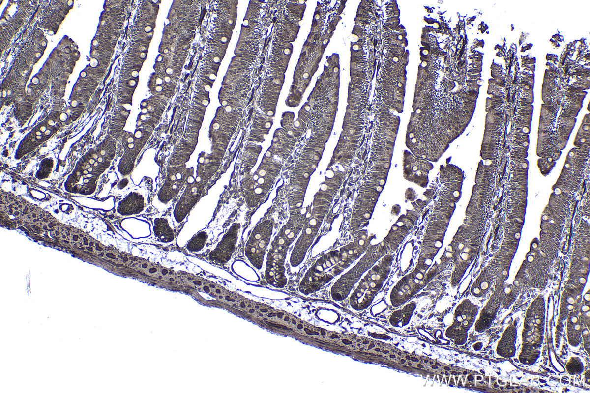 Immunohistochemical analysis of paraffin-embedded rat small intestine tissue slide using KHC1427 (CHK1 IHC Kit).