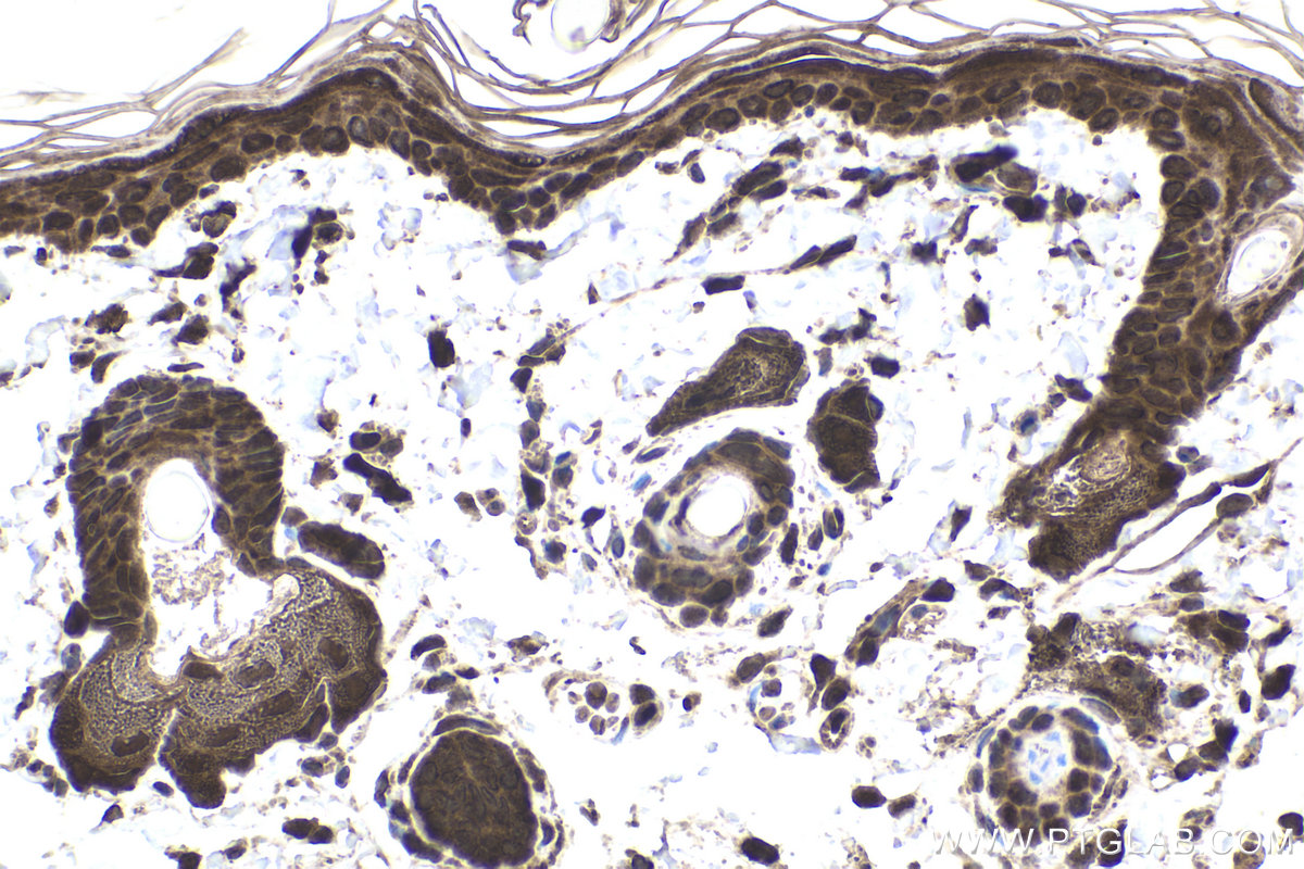 Immunohistochemical analysis of paraffin-embedded rat skin tissue slide using KHC1951 (CHMP1A IHC Kit).