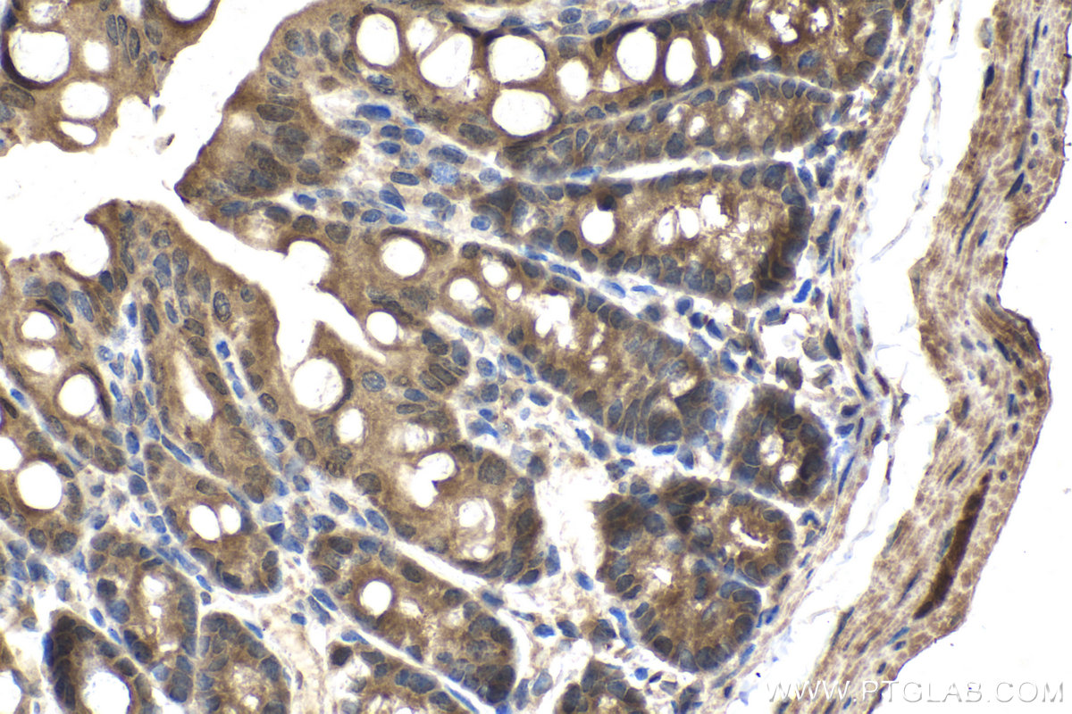 Immunohistochemical analysis of paraffin-embedded mouse colon tissue slide using KHC1455 (CHMP2A IHC Kit).