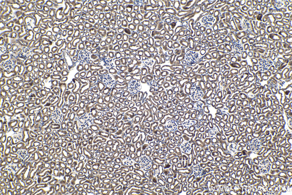 Immunohistochemical analysis of paraffin-embedded mouse kidney tissue slide using KHC1455 (CHMP2A IHC Kit).