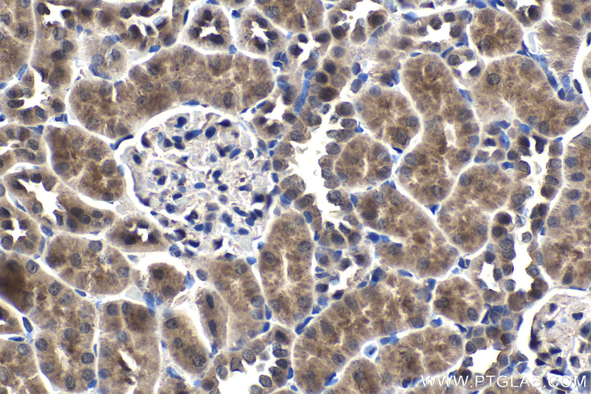 Immunohistochemical analysis of paraffin-embedded rat kidney tissue slide using KHC1455 (CHMP2A IHC Kit).