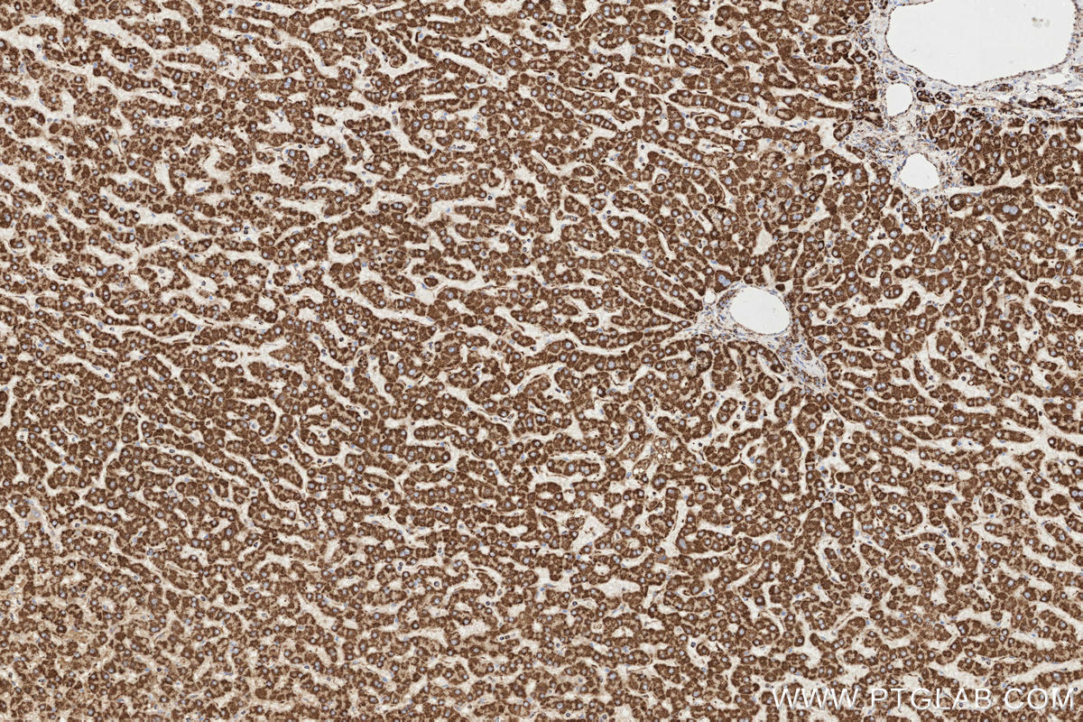Immunohistochemical analysis of paraffin-embedded human hepatocirrhosis tissue slide using KHC3297 (CHST13 IHC Kit).
